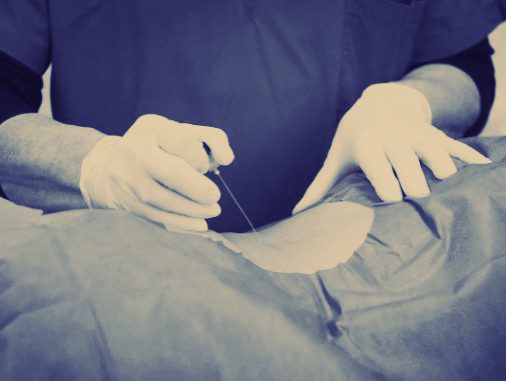 Injection de PRP rachidienne